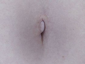 300人のへそ 2　サンプル画像09